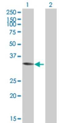 Western Blot: ACY3 Antibody [H00091703-B01P]