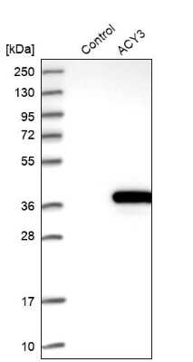 Western Blot: ACY3 Antibody [NBP1-89256]