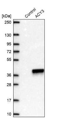 Western Blot: ACY3 Antibody [NBP2-48895]