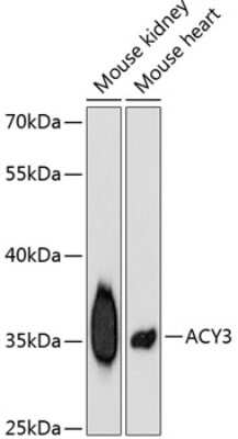 Western Blot: ACY3 AntibodyBSA Free [NBP2-92453]