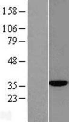 Western Blot: ACY3 Overexpression Lysate [NBL1-07301]