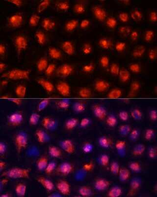 Immunocytochemistry/ Immunofluorescence: ACYP1 Antibody - Azide and BSA Free [NBP3-04823]