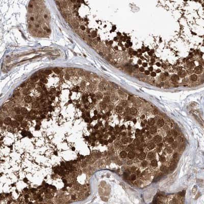 Immunohistochemistry-Paraffin: ACYP1 Antibody [NBP1-86314]