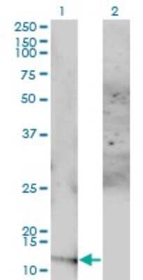 Western Blot: ACYP1 Antibody (S3) [H00000097-M01]