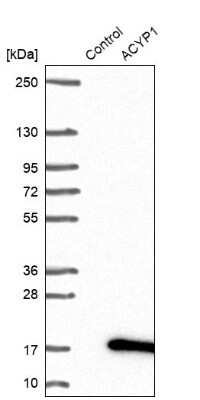 Western Blot: ACYP1 Antibody [NBP1-86314]