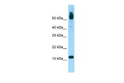 Western Blot: ACYP1 Antibody [NBP2-86953]