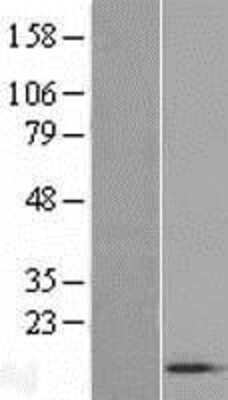 Western Blot: ACYP1 Overexpression Lysate [NBL1-07302]