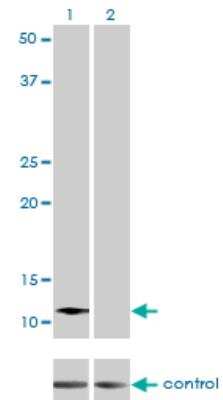 Western Blot: ACYP2 Antibody (2H7) [H00000098-M06]