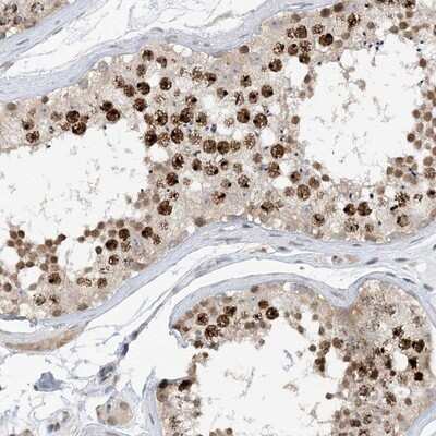 Immunohistochemistry-Paraffin: ACYP2 Antibody [NBP1-86308]