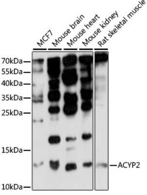 Western Blot: ACYP2 AntibodyBSA Free [NBP2-92256]