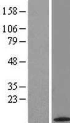 Western Blot: ACYP2 Overexpression Lysate [NBL1-07303]