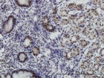 Immunohistochemistry-Paraffin: ADA2 beta Antibody (1C8) [H00093624-M08]