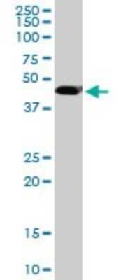 Western Blot: ADA2 beta Antibody (1C8) [H00093624-M08]