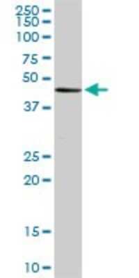 Western Blot: ADA2 beta Antibody (1C8) [H00093624-M08]