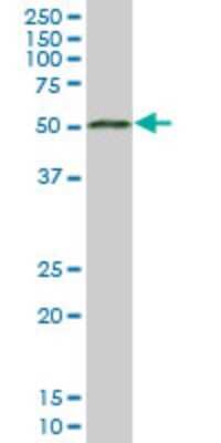 Western Blot: ADA2 beta Antibody (3F3) [H00093624-M06]