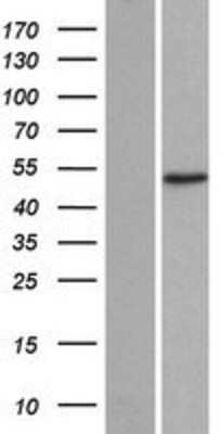 Western Blot: ADA2 beta Overexpression Lysate [NBP2-05406]