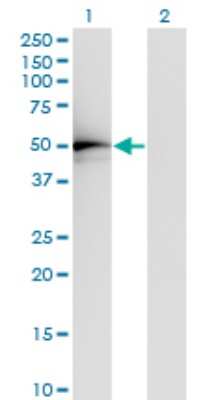 Western Blot: ADA2a Antibody (4A8-1A7) [H00006871-M01]