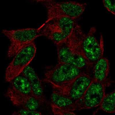 Immunocytochemistry/ Immunofluorescence: ADA2a Antibody [NBP2-57507]