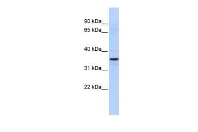 Western Blot: ADA2a Antibody [NBP2-86955]