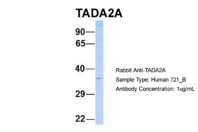 Western Blot: ADA2a Antibody [NBP2-86955]