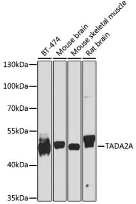 Western Blot: ADA2a AntibodyBSA Free [NBP2-92547]