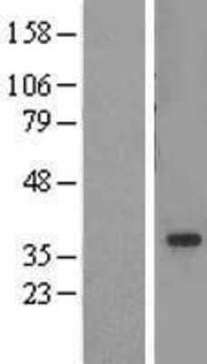 Western Blot: ADA2a Overexpression Lysate [NBL1-16676]