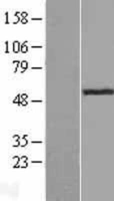 Western Blot: ADA2a Overexpression Lysate [NBP2-11480]