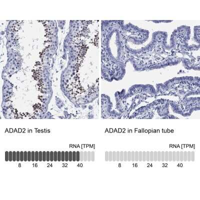 Immunocytochemistry/ Immunofluorescence: ADAD2 Antibody [NBP3-17119]