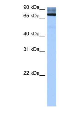 Western Blot: ADAD2 Antibody [NBP1-57403]