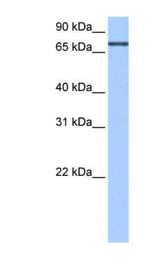 Western Blot: ADAD2 Antibody [NBP1-57511]