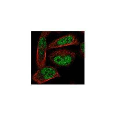 Immunocytochemistry/ Immunofluorescence: ADAL Antibody [NBP3-17207]