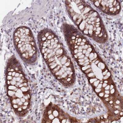 Immunohistochemistry-Paraffin: ADAL Antibody [NBP2-14263]