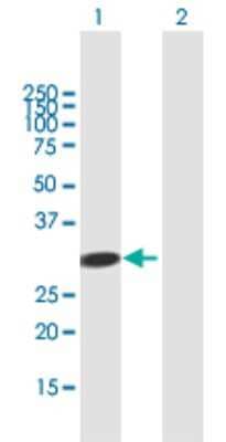 Western Blot: ADAL Antibody [H00161823-B01P]