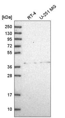 Western Blot: ADAL Antibody [NBP2-55056]