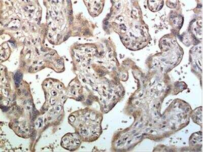 Immunohistochemistry-Paraffin: ADAM10 Antibody (MM0077-6D31) - Azide and BSA Free [NBP2-12014]