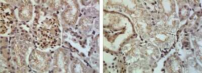 Immunohistochemistry-Paraffin: ADAM10 Antibody (RM0146-7H12) - Azide and BSA Free [NBP2-12015]