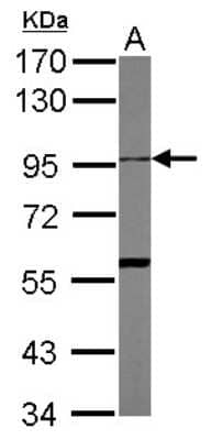 Western Blot: ADAM10 Antibody [NBP2-15280]