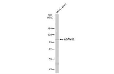 Western Blot: ADAM10 Antibody [NBP2-15280]