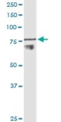 Western Blot: ADAM11 Antibody (3D4) [H00004185-M01]