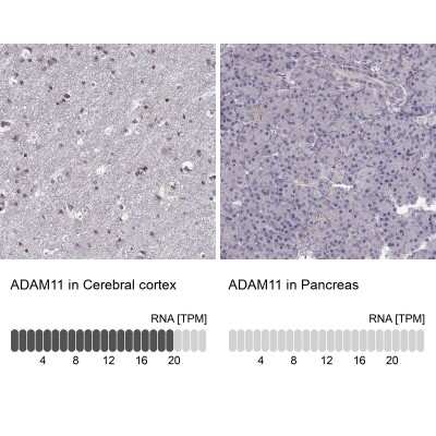 Immunohistochemistry-Paraffin: ADAM11 Antibody [NBP2-62689]