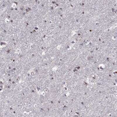 Immunohistochemistry-Paraffin: ADAM11 Antibody [NBP2-62689]