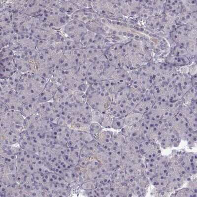 Immunohistochemistry-Paraffin: ADAM11 Antibody [NBP2-62689]