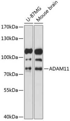 Western Blot: ADAM11 AntibodyAzide and BSA Free [NBP2-92621]