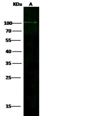 Western Blot: ADAM12 Antibody (737) [NBP2-89702]