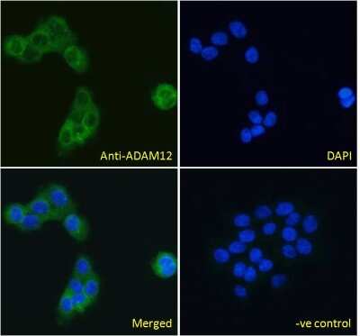 Immunocytochemistry/ Immunofluorescence: ADAM12 Antibody [NB300-889]