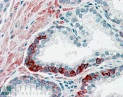 Immunohistochemistry-Paraffin: ADAM12 Antibody [NB300-889]