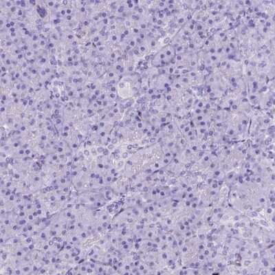 Immunohistochemistry-Paraffin: ADAM12 Antibody [NBP1-82791]