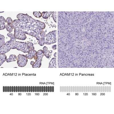 Immunohistochemistry-Paraffin: ADAM12 Antibody [NBP1-82791]