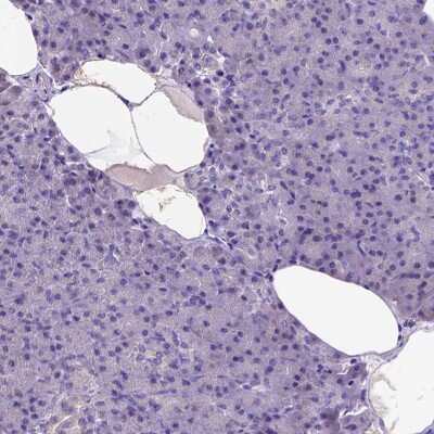 Immunohistochemistry-Paraffin: ADAM12 Antibody [NBP2-33939]