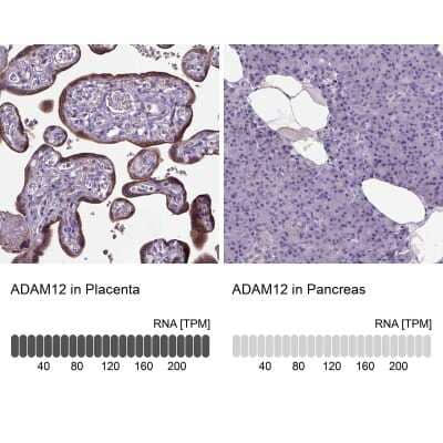 Immunohistochemistry-Paraffin: ADAM12 Antibody [NBP2-33939]